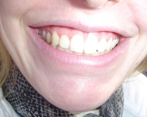 à qui cette dentition d'exception ?